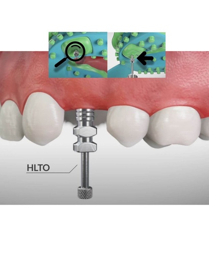 Трансфер для открытой ложки CHC - фото №3
