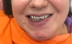 15-2 - фото